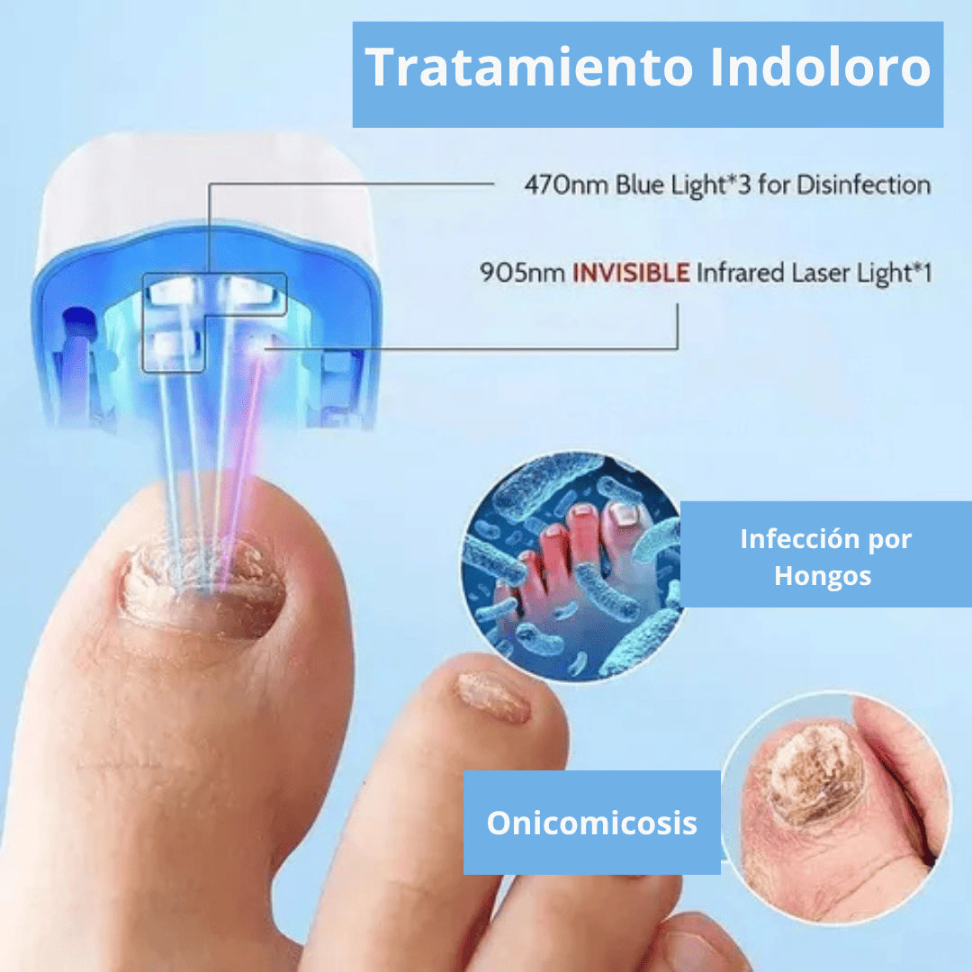 CuraNails®| Uñas libres de hongos.