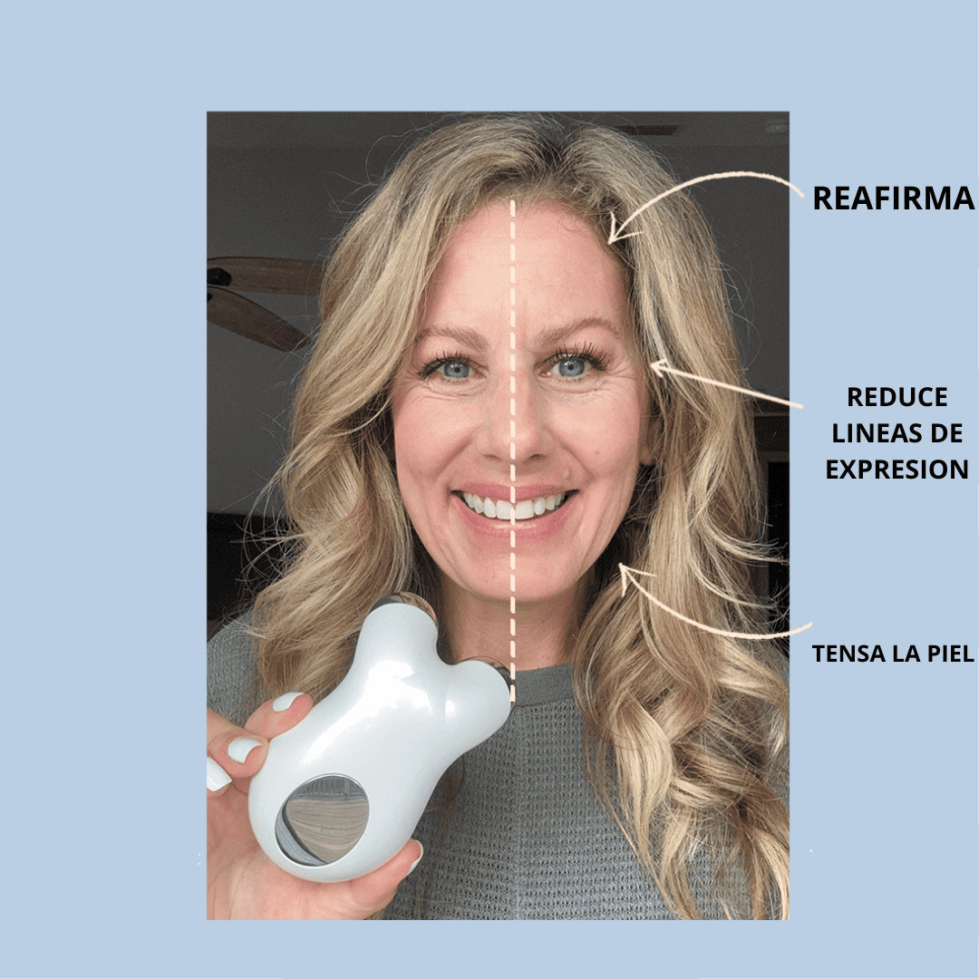 GlowLift® | tonifica y rejuvenece.